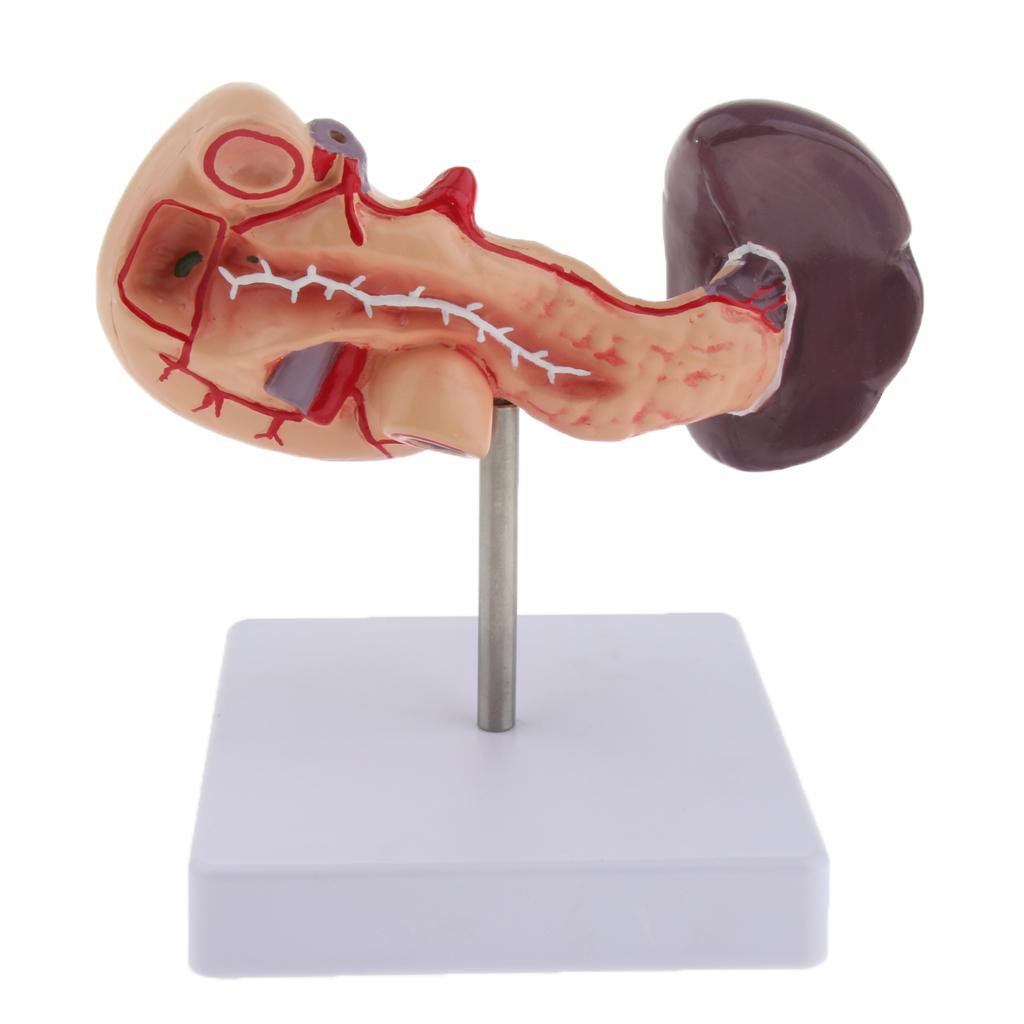 Premium Life Size Anatomical Pancreas, Duodenum, Spleen Model With Base - Human Anatomy