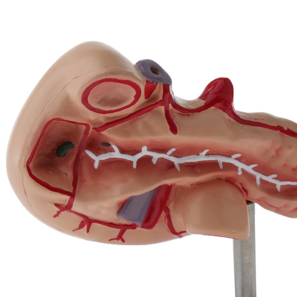 Premium Life Size Anatomical Pancreas, Duodenum, Spleen Model With Base - Human Anatomy