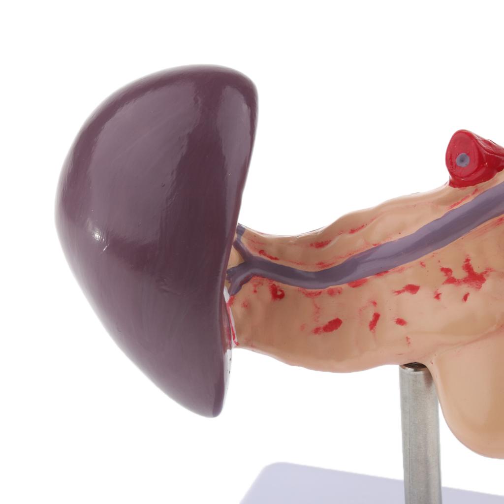 Premium Life Size Anatomical Pancreas, Duodenum, Spleen Model With Base - Human Anatomy