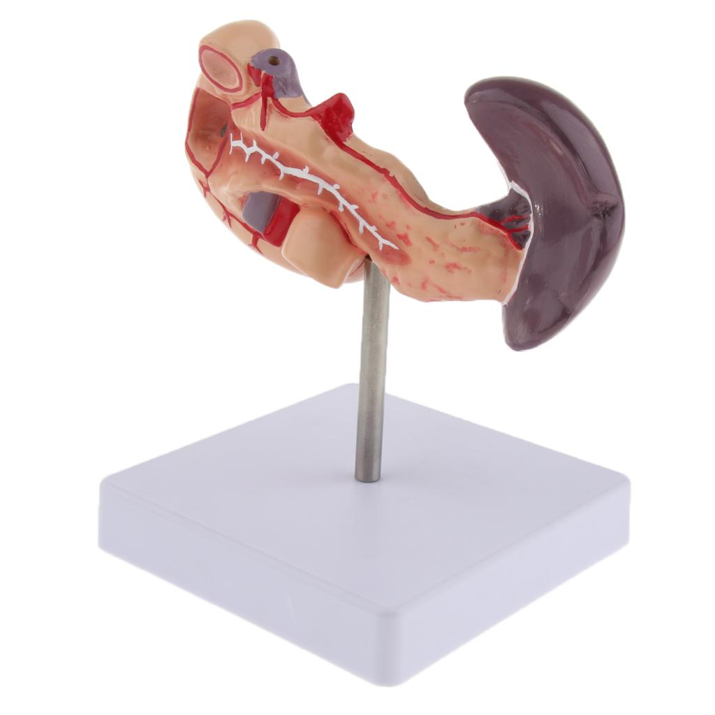 Premium Life Size Anatomical Pancreas, Duodenum, Spleen Model With Base - Human Anatomy