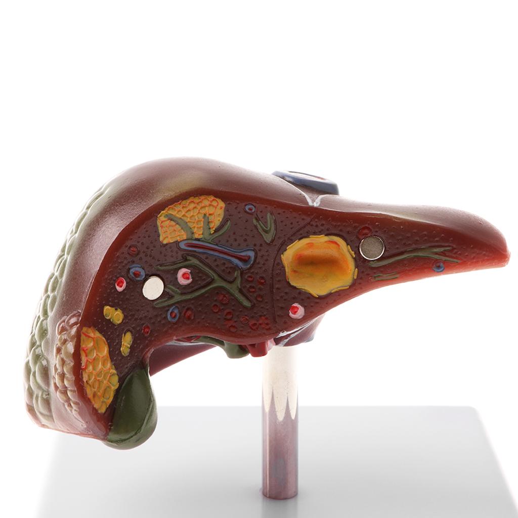 Human Diseased Liver Pathological Anatomical Model, Lab Medical Equipment