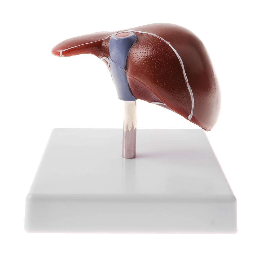 Human Diseased Liver Pathological Anatomical Model, Lab Medical Equipment