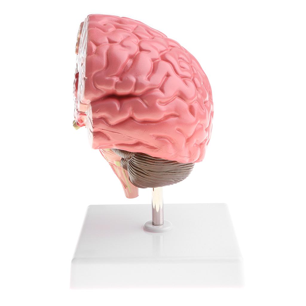 Anatomical Human Brain Disease Pathological Model Medical Teaching Tool Lab