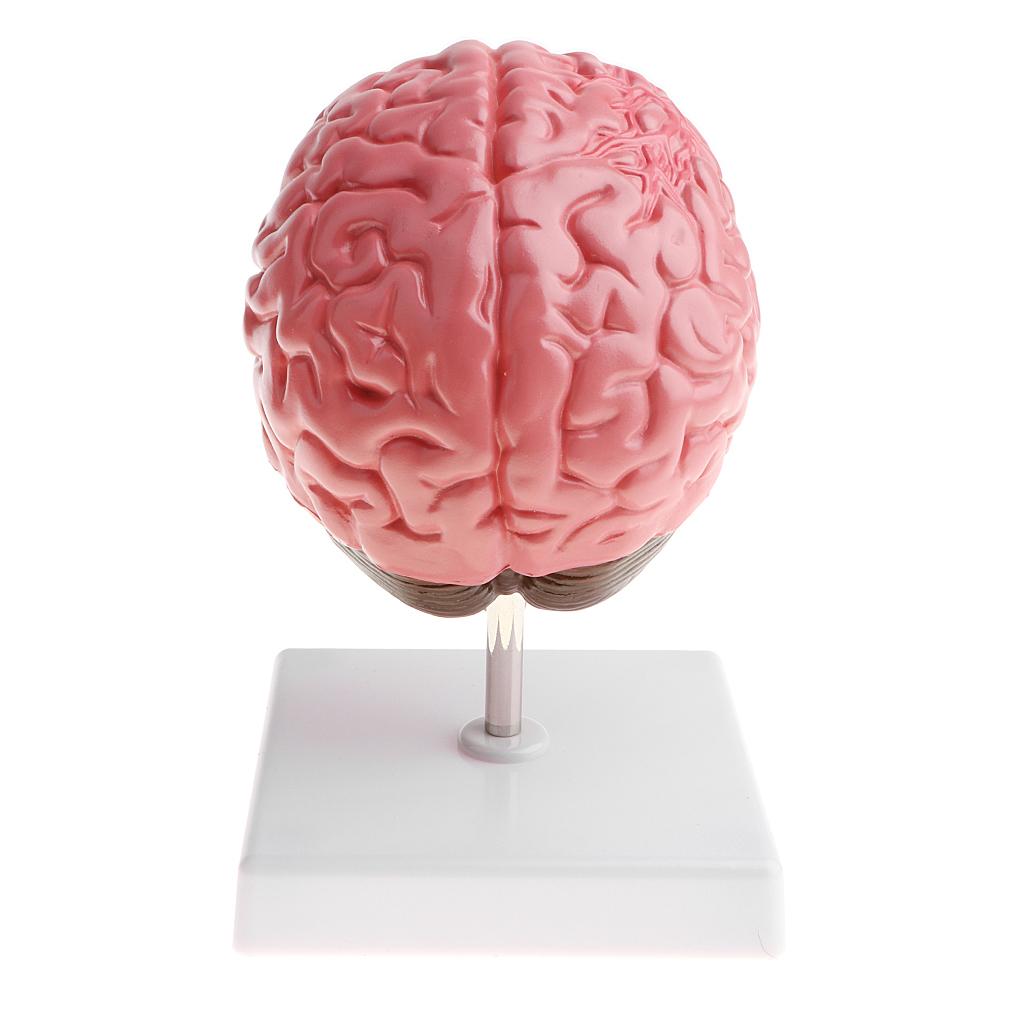 Anatomical Human Brain Disease Pathological Model Medical Teaching Tool Lab