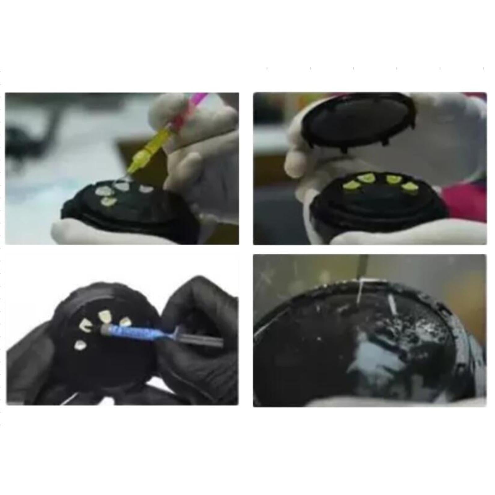 Full Protection Veneers Replace Portable Partial Box