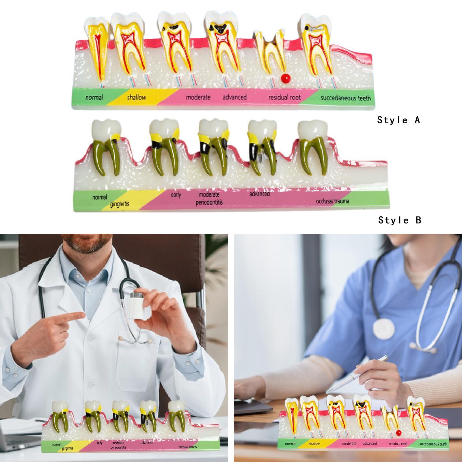 Demonstration Tooth Model Education Standard Tooth for School Classroom Kids Style A