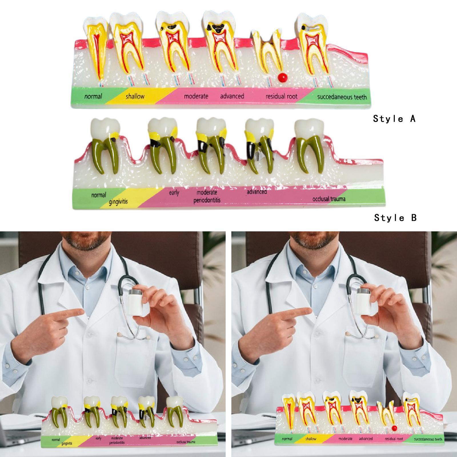 Demonstration Tooth Model Education Standard Tooth for School Classroom Kids Style A