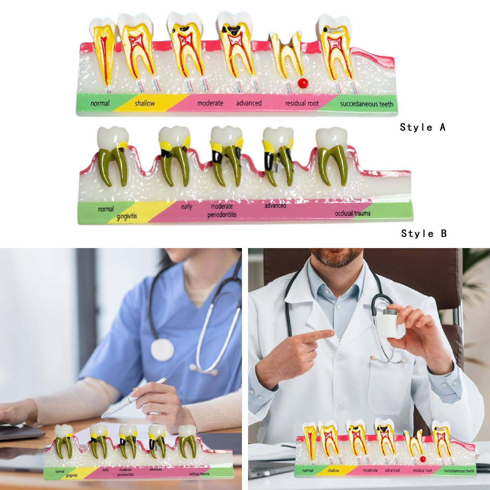 Demonstration Tooth Model Education Standard Tooth for School Classroom Kids Style A