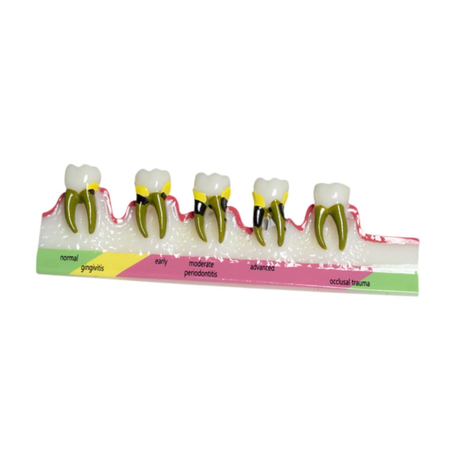Demonstration Tooth Model Education Standard Tooth for School Classroom Kids Style B
