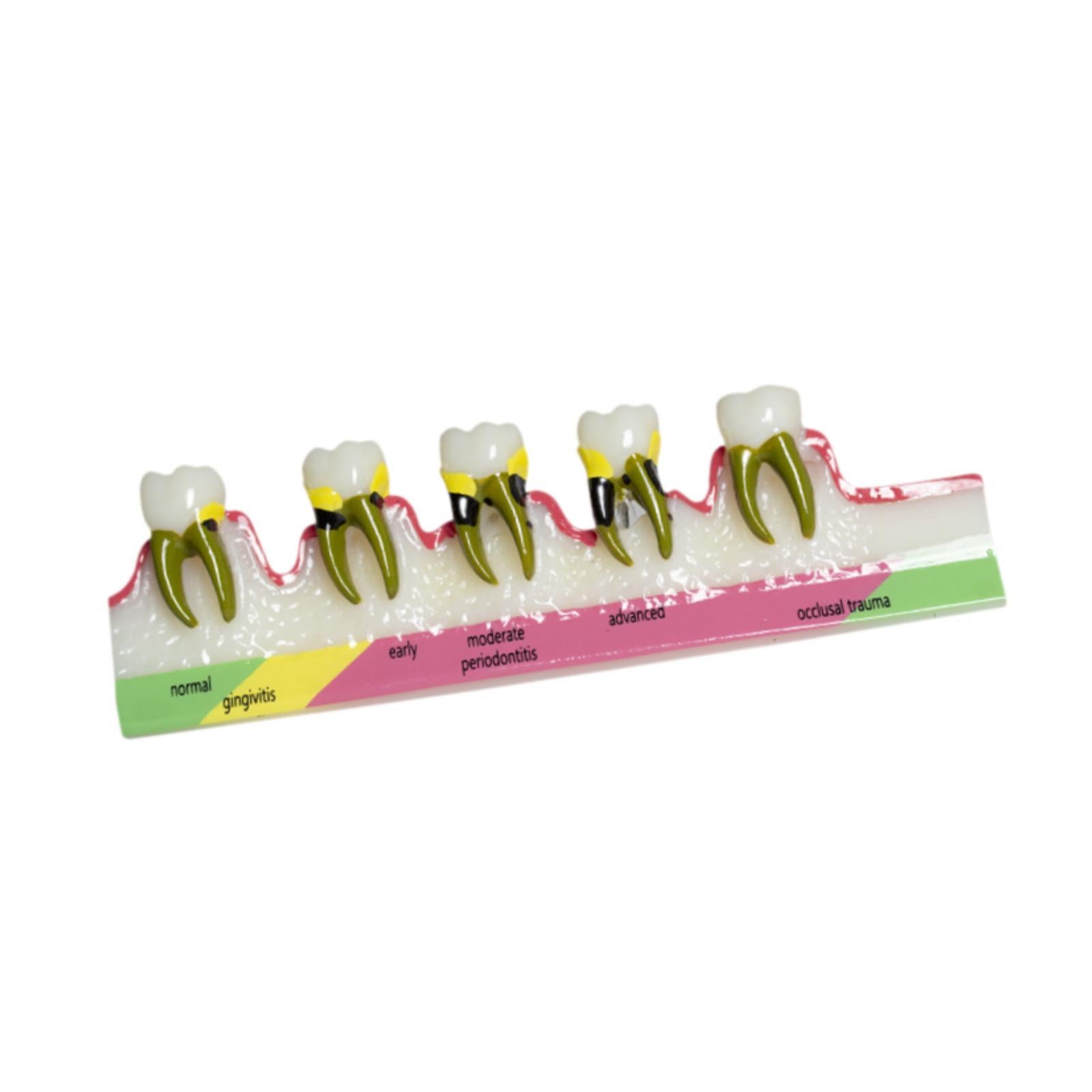 Demonstration Tooth Model Education Standard Tooth for School Classroom Kids Style B