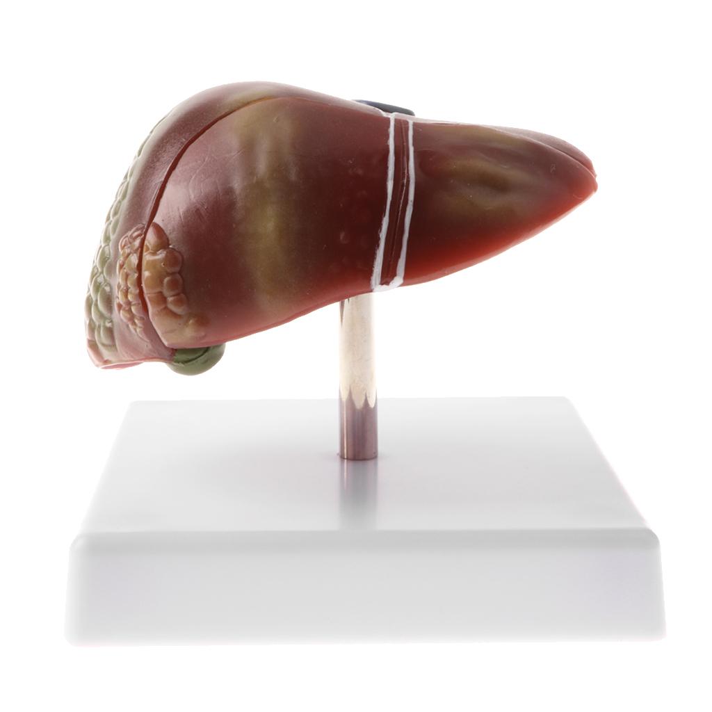 Human Diseased Liver Pathological Anatomical Model, Lab Medical Equipment