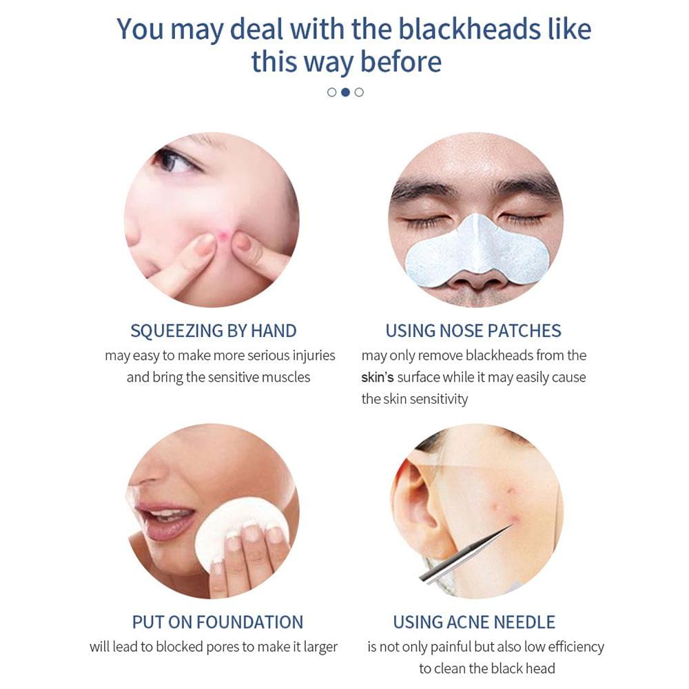 2.0MP Wireless WiFi Intelligent Visual Blackhead Remover - WIFI