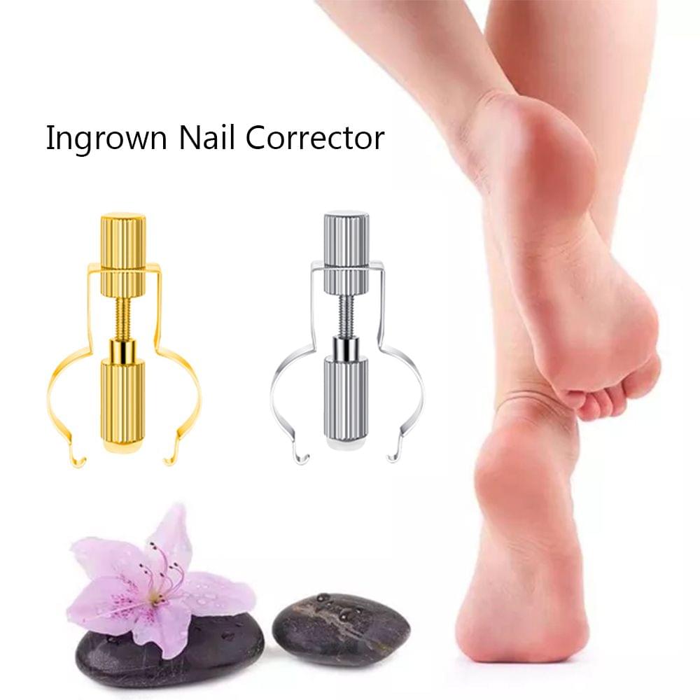 Ingrown Nail Corrector Ingrown Toe Nail Treatments Tools for