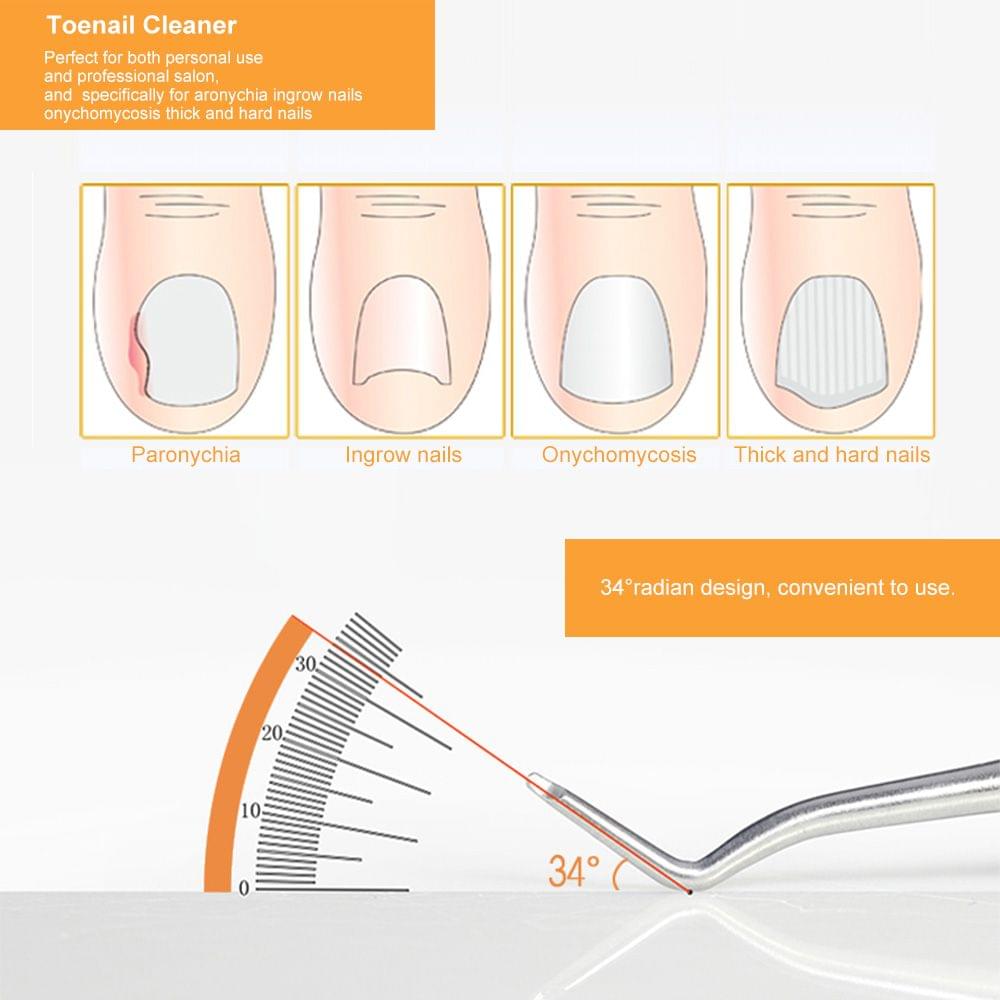 Toenail Cleaner Ingrowing File Nail Care Chiropody Tool