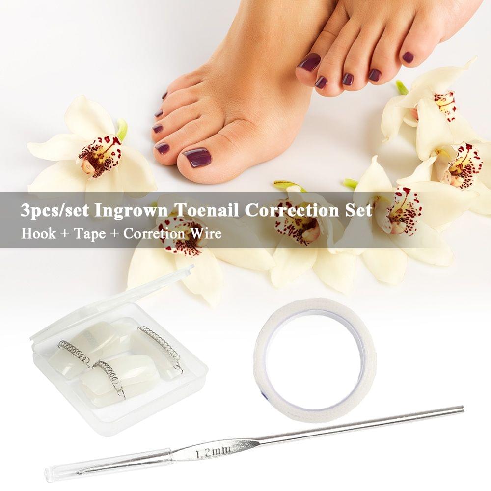 3pcs/set Ingrown Toenail Correction Steel Hook Wire Fixer - M