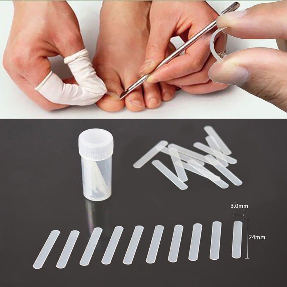 10pcs A Incarnated Curve Runner BS Brace Paronychia Thick Hair Nail Correction Tool Great Popular