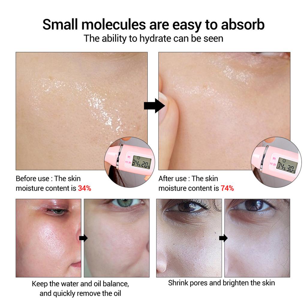 15ml Face Serum Essence Blackhead Removing Repairing Hyaluronic Acid