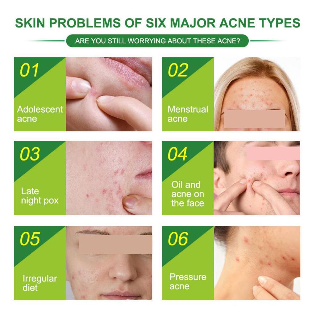 24pcs Acne Stickers Acne Patch Transparent Invisible Remover