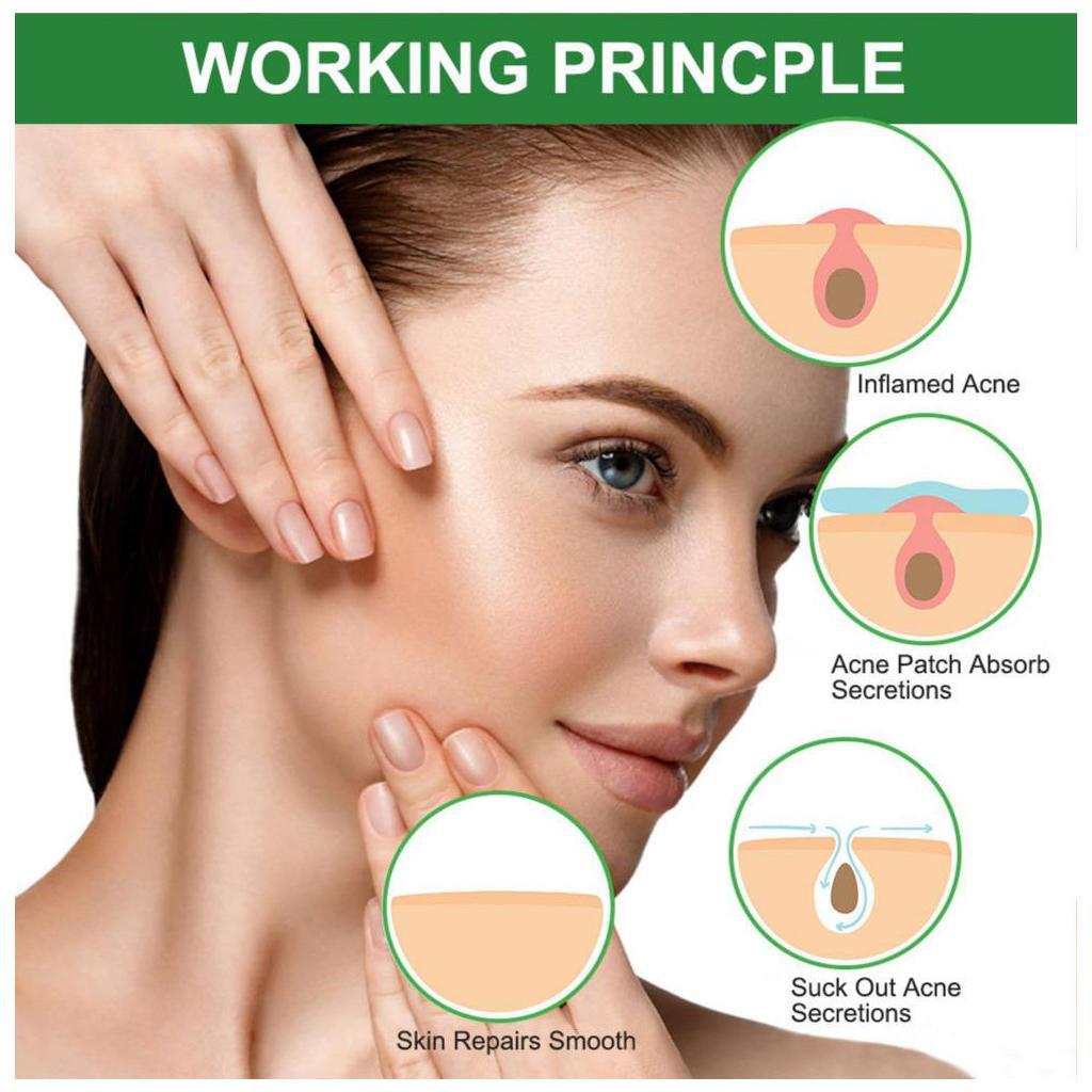 24pcs Acne Stickers Acne Patch Transparent Invisible Remover