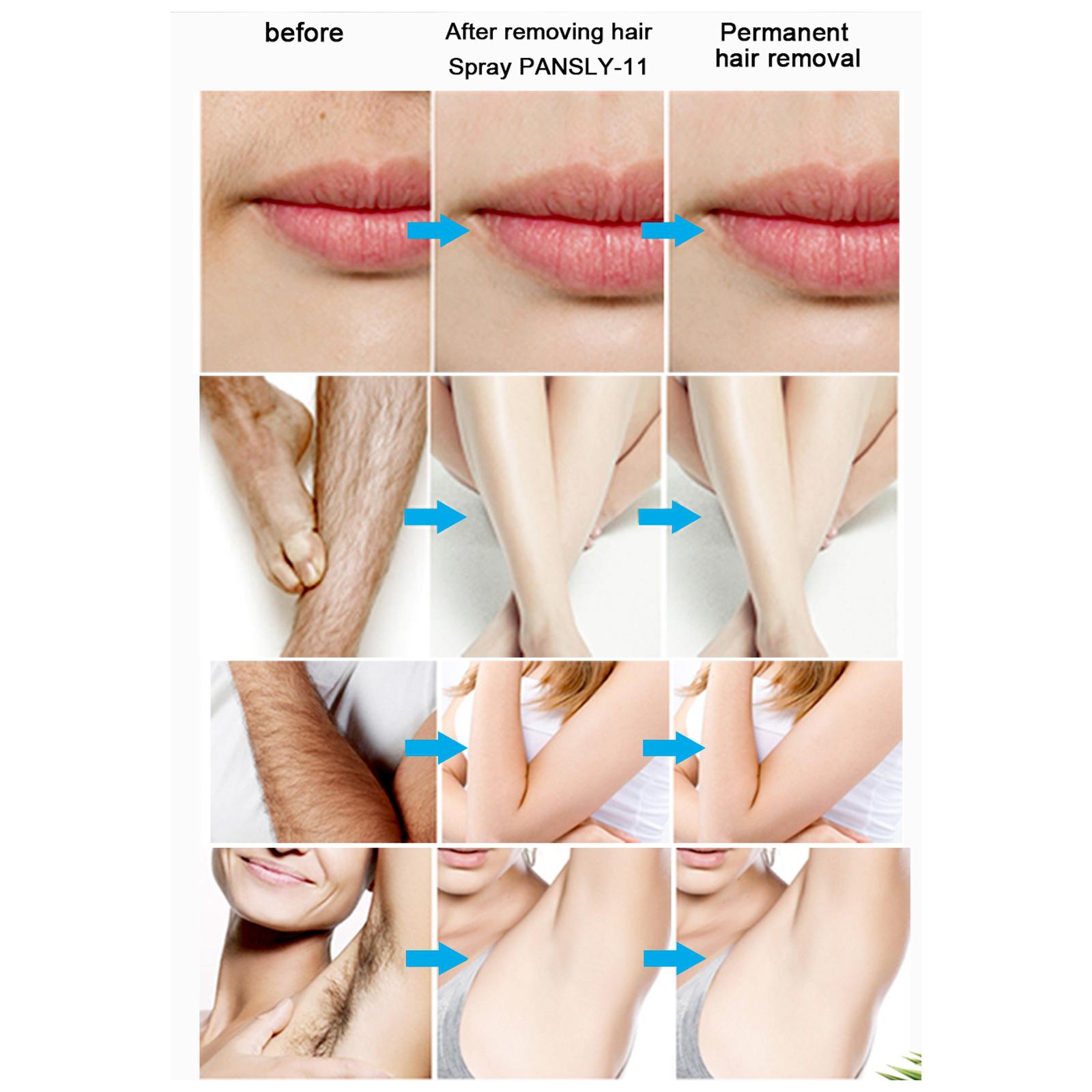 Mild Hair Growth Inhibitor Cream Spray Hair Remover Stop Hair Growth 20ML
