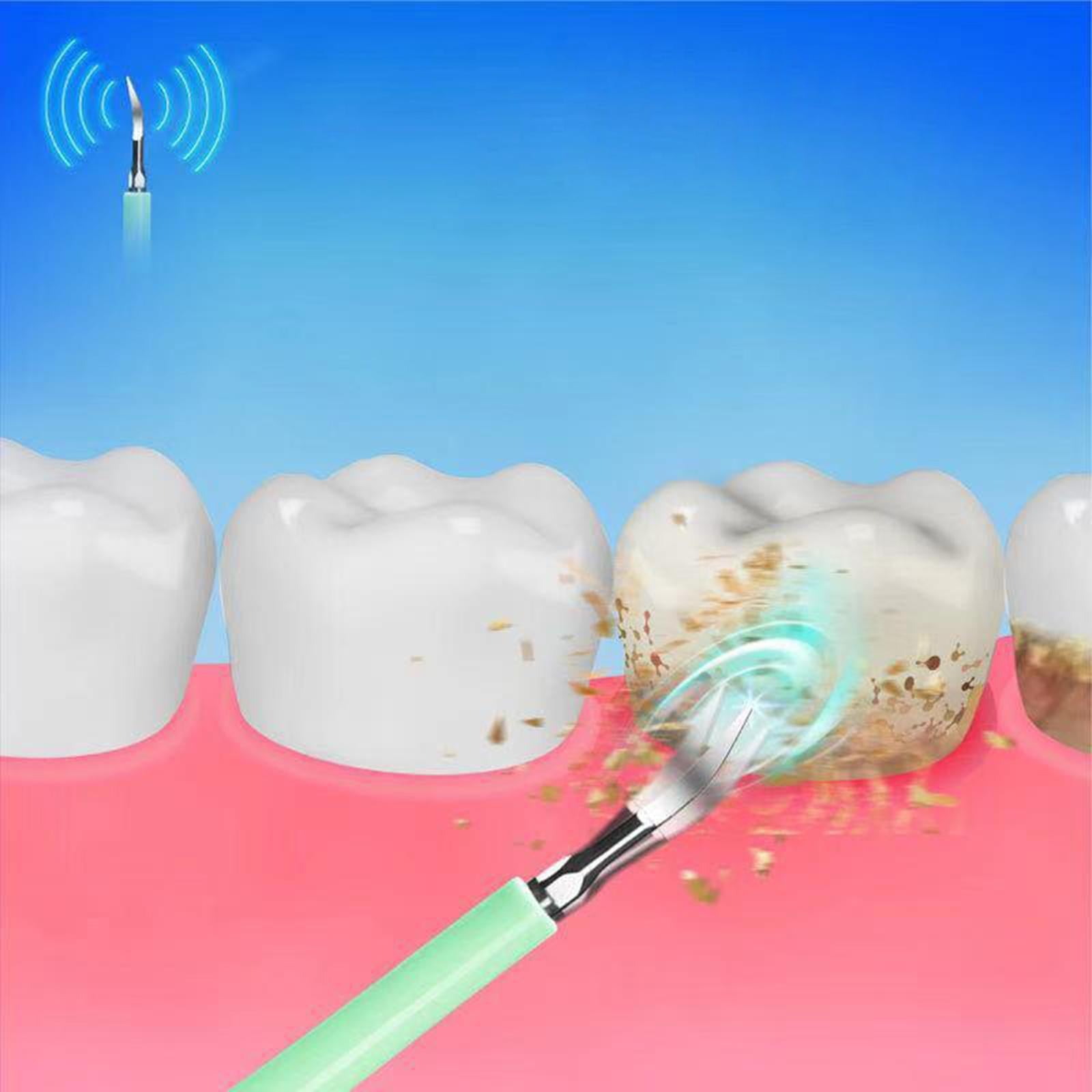 Electric Ultrasonic Tooth Cleaner Waterproof Oral Clean with 5 Modes Green