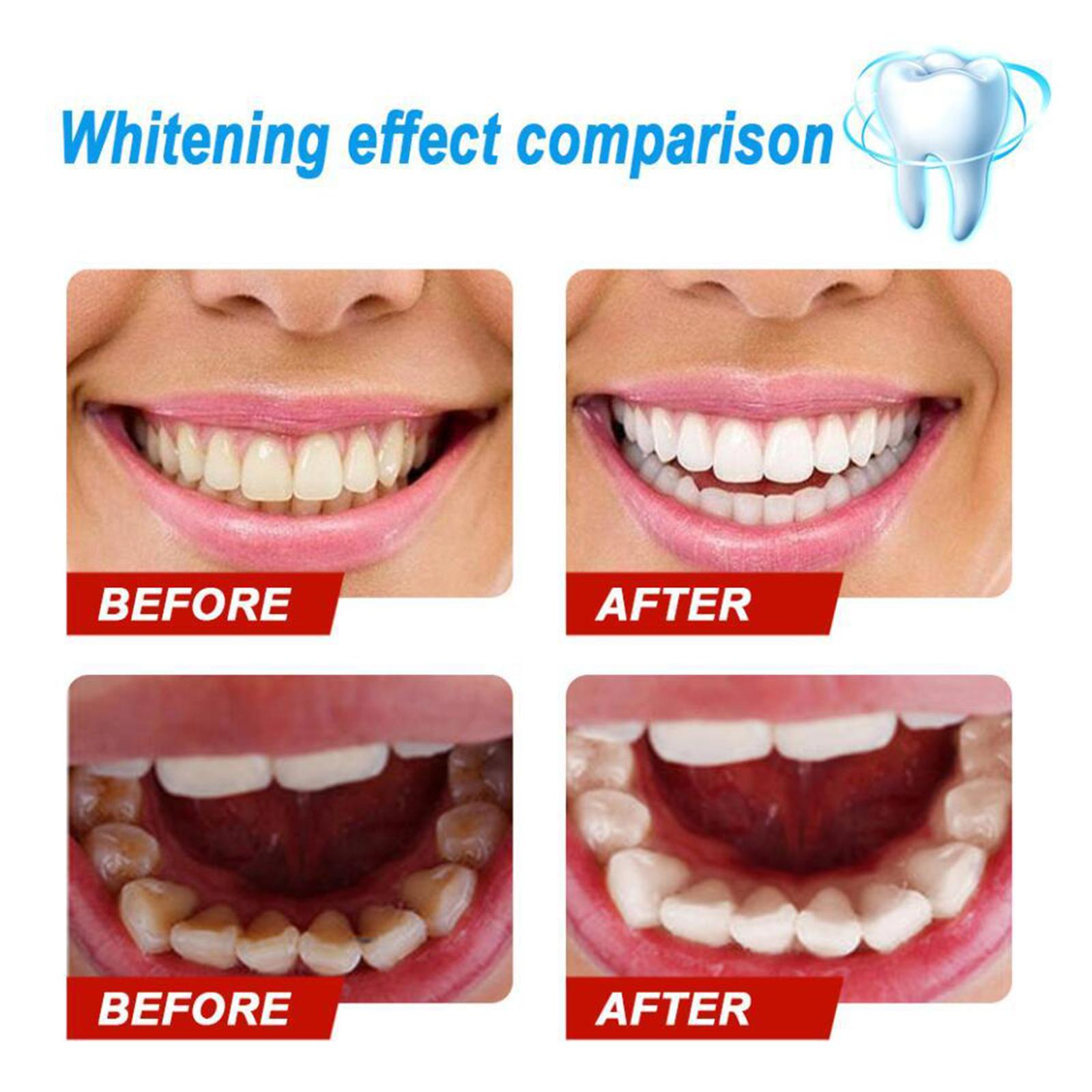 Fruit Flavor Baking Soda Toothpaste Strong Cleaning Stain Apple