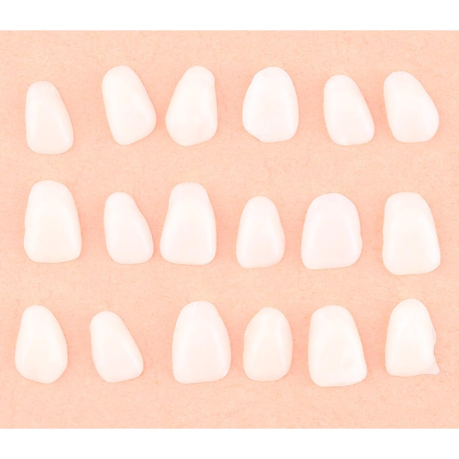 Ultra-Thin Teeth Temporary Veneers Anterior Resin Whitening Mixed Type White