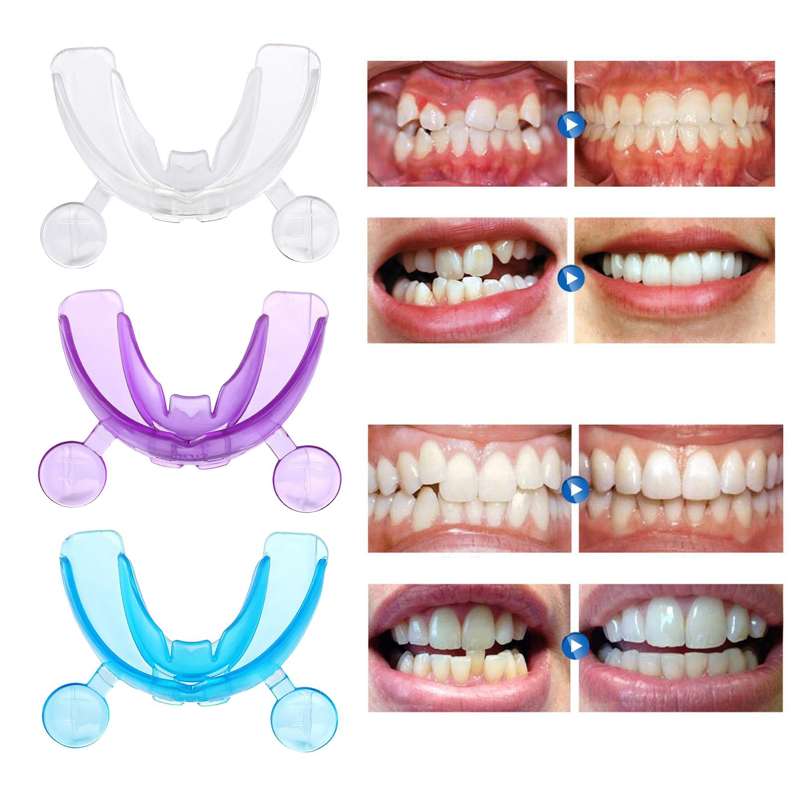 Dental Mouth Guard for Grinding Teeth Tooth Protector Night Guard Clear