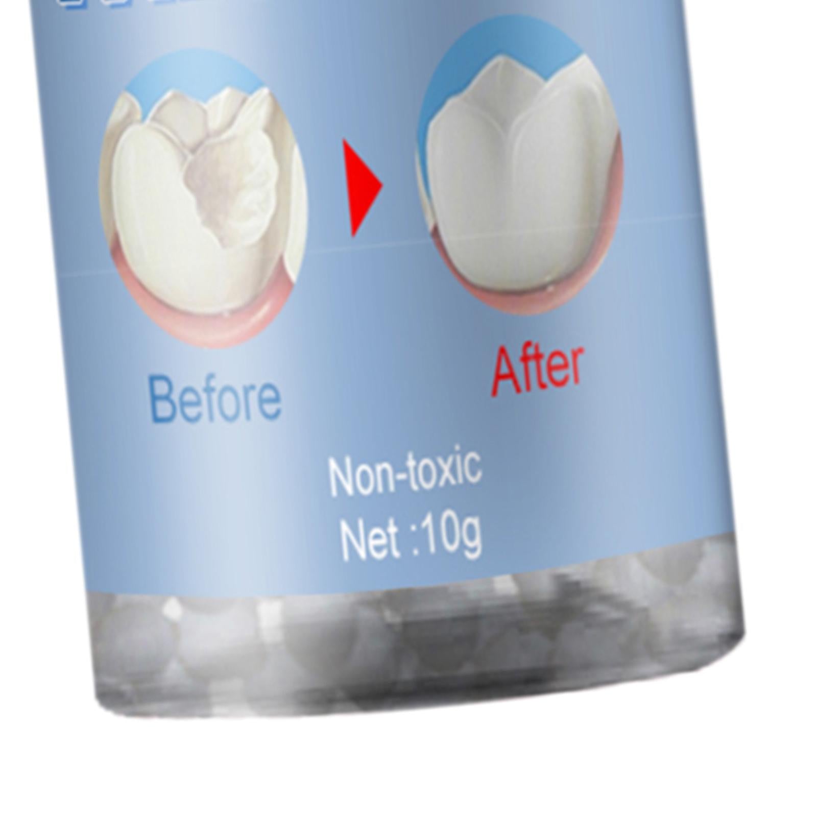 1 Bottle Thermal Fitting Beads Temporary Teeth Repair Thermal Beads 10ml