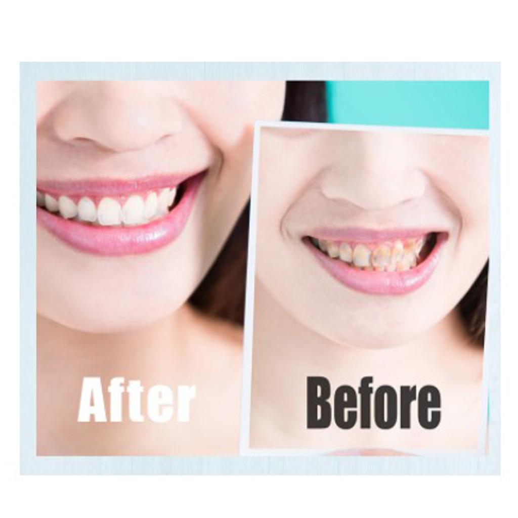 Home Use Wireless Teeth Whitening LED Light  Effective Stain Removal Black