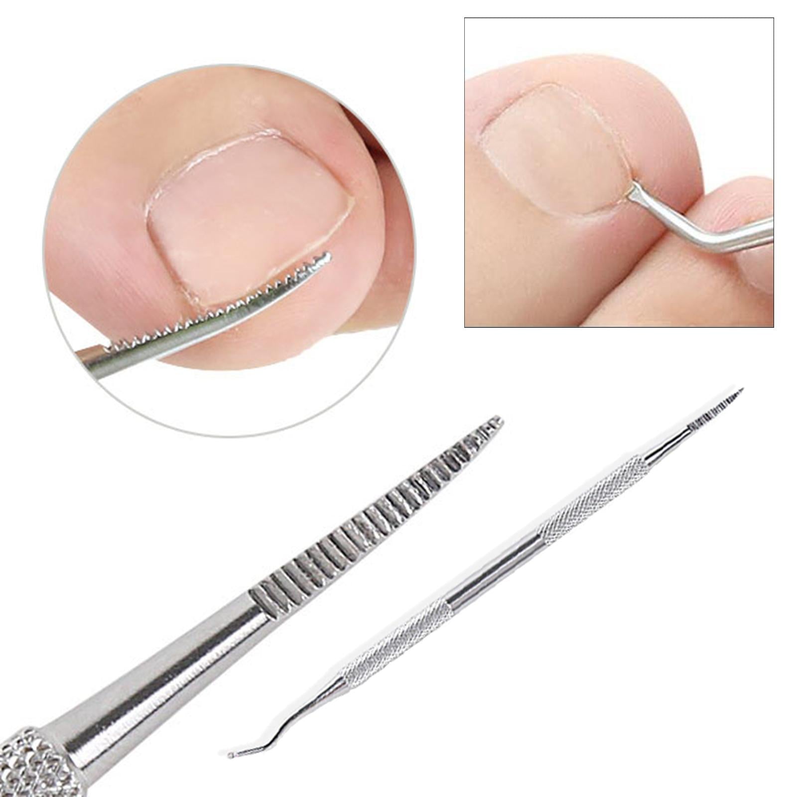Ingrown Toenail Tool Set Stainless Steel for Cleaning Ingrown Toenails