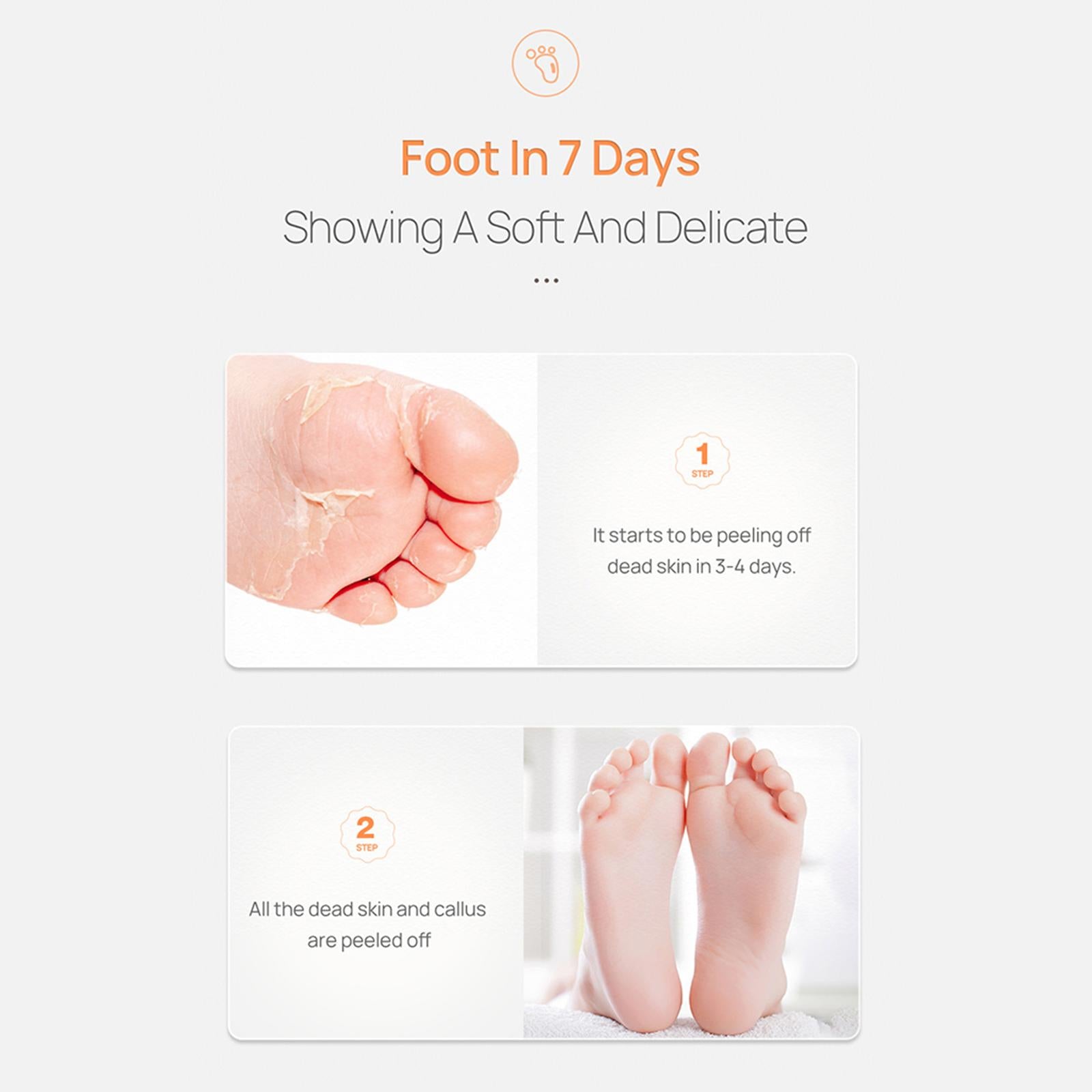 Foot Peel Masks Peeling Remover Soothe Feet for Cracked Feet Treatment vitamin C