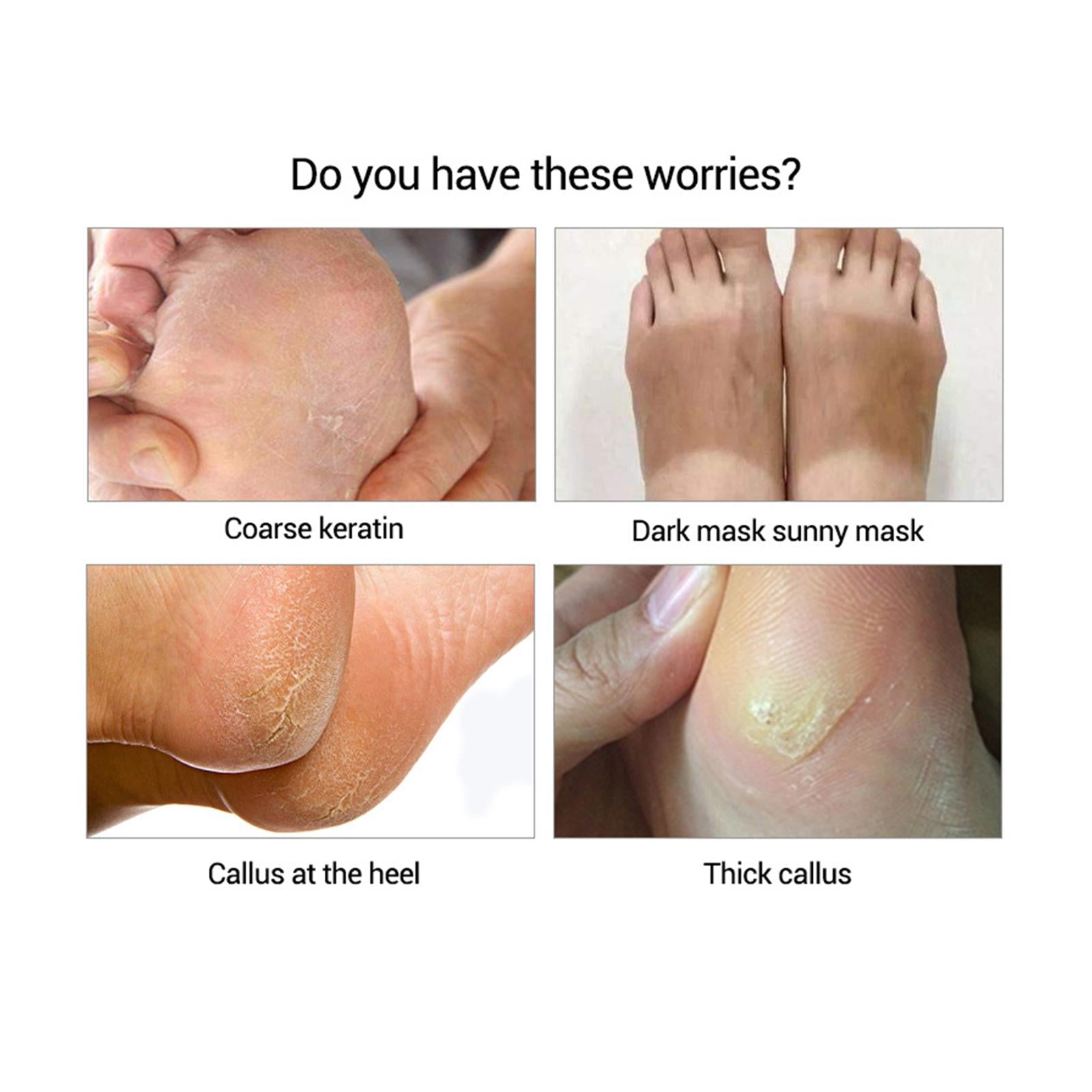 Foot Peel Masks Peeling Remover Soothe Feet for Cracked Feet Treatment No fragrance