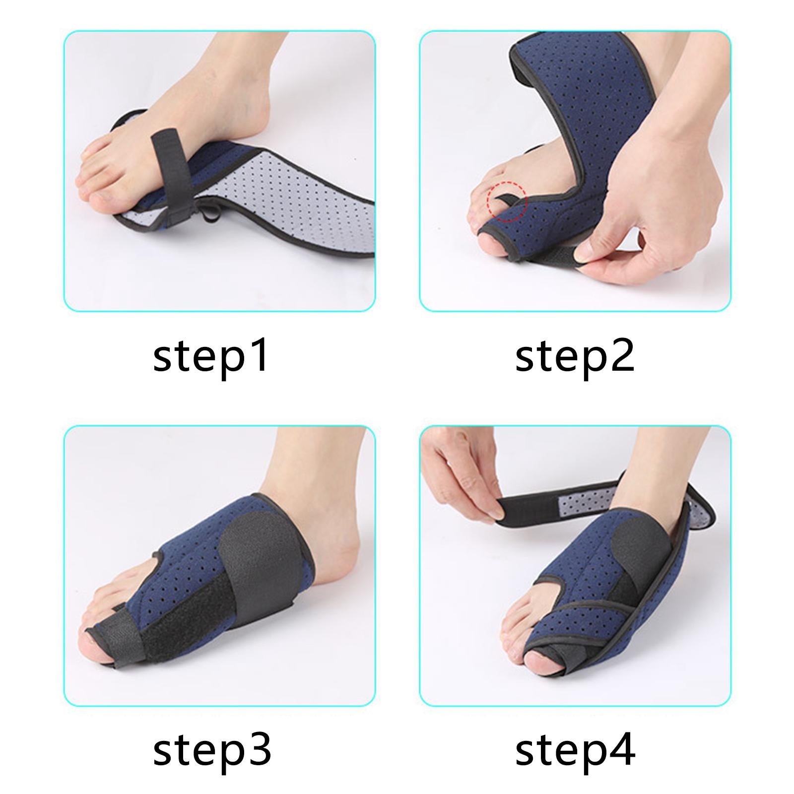 Bunion Corrector Self-Adhesive Bunion Splints for Foot Pain Overlapping Toes Right S
