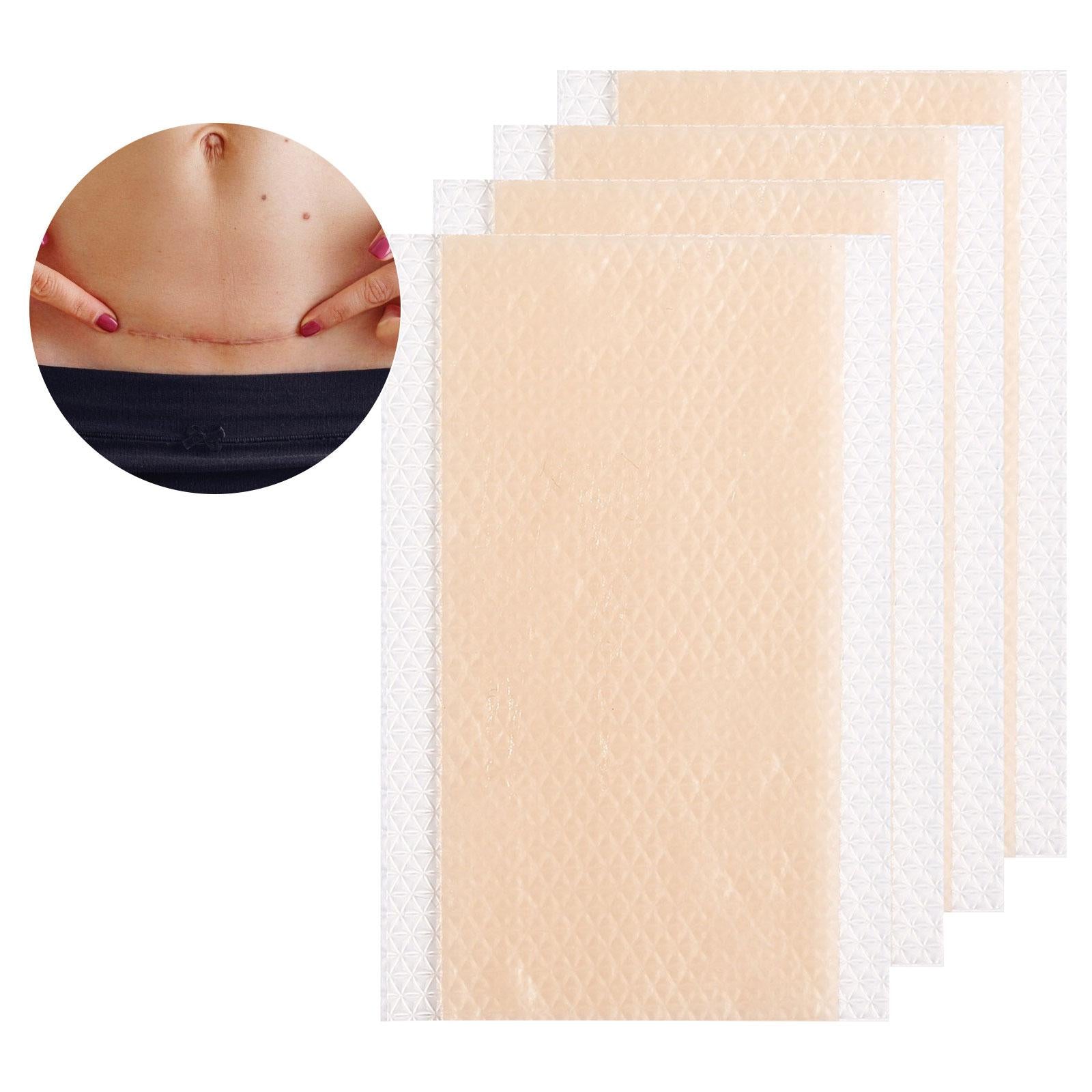 Silicone Scar Stickers Self-Adhesive Soft Silicone Sheets for Scars Women