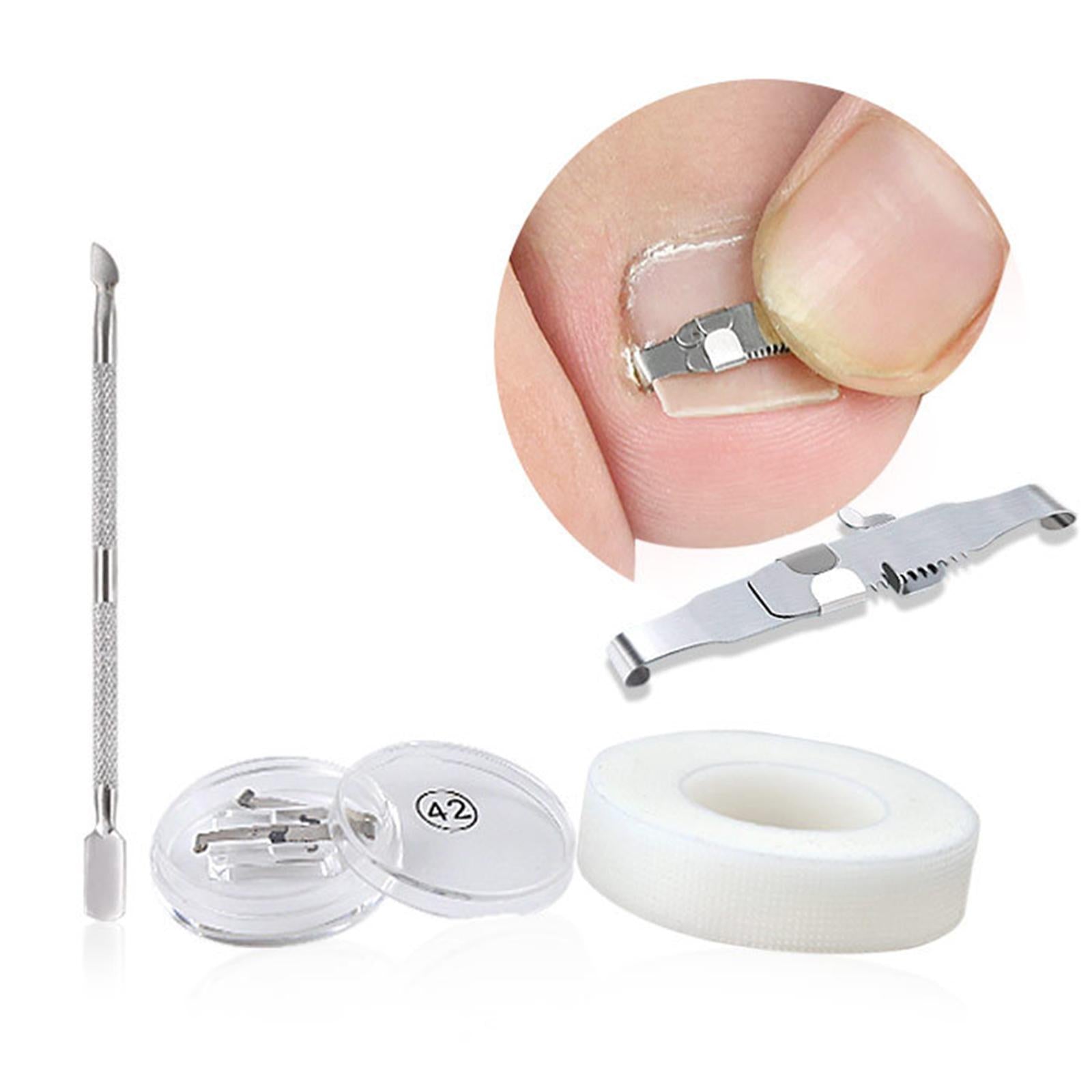 Ingrown Toenail Correction Tool Stainless Steel Reusable Foot Care 36