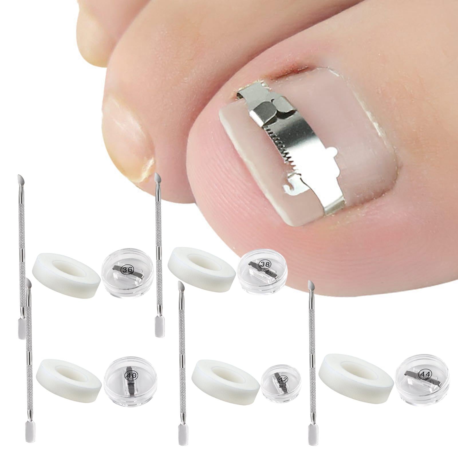 Ingrown Toenail Correction Tool Stainless Steel Reusable Foot Care 36