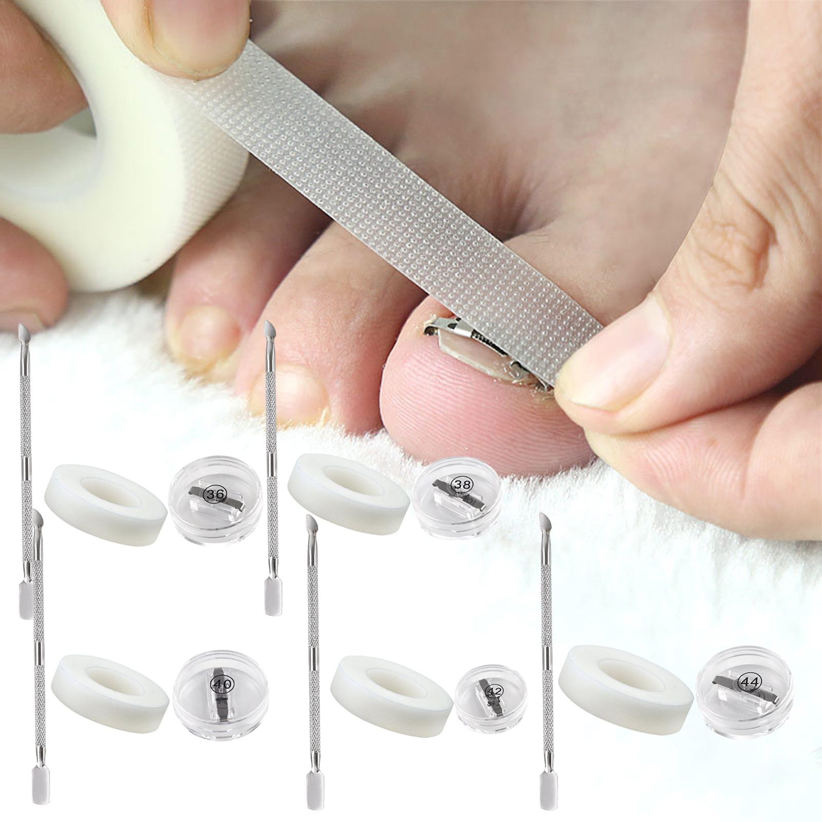 Ingrown Toenail Correction Tool Stainless Steel Reusable Foot Care 36