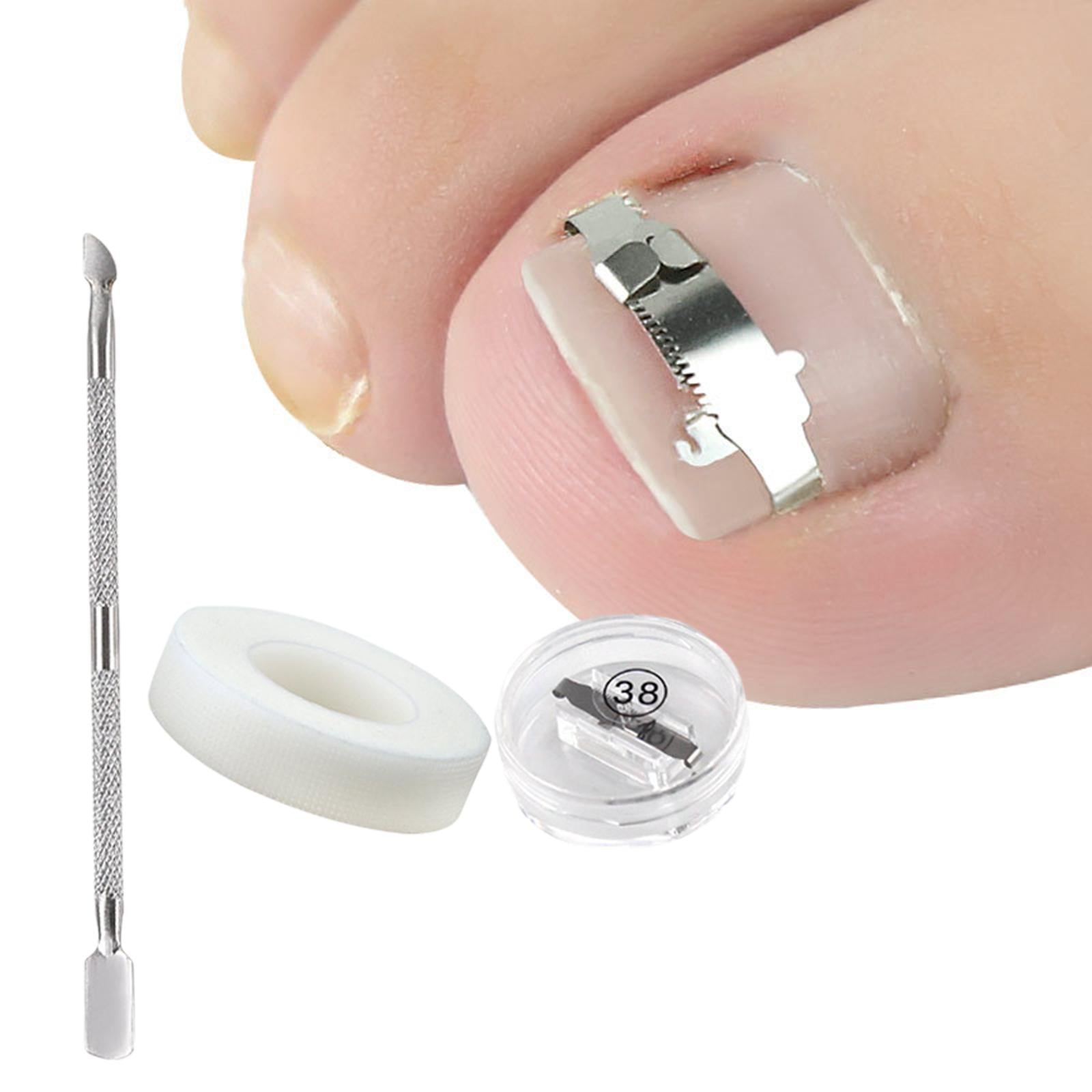Ingrown Toenail Correction Tool Stainless Steel Reusable Foot Care 38