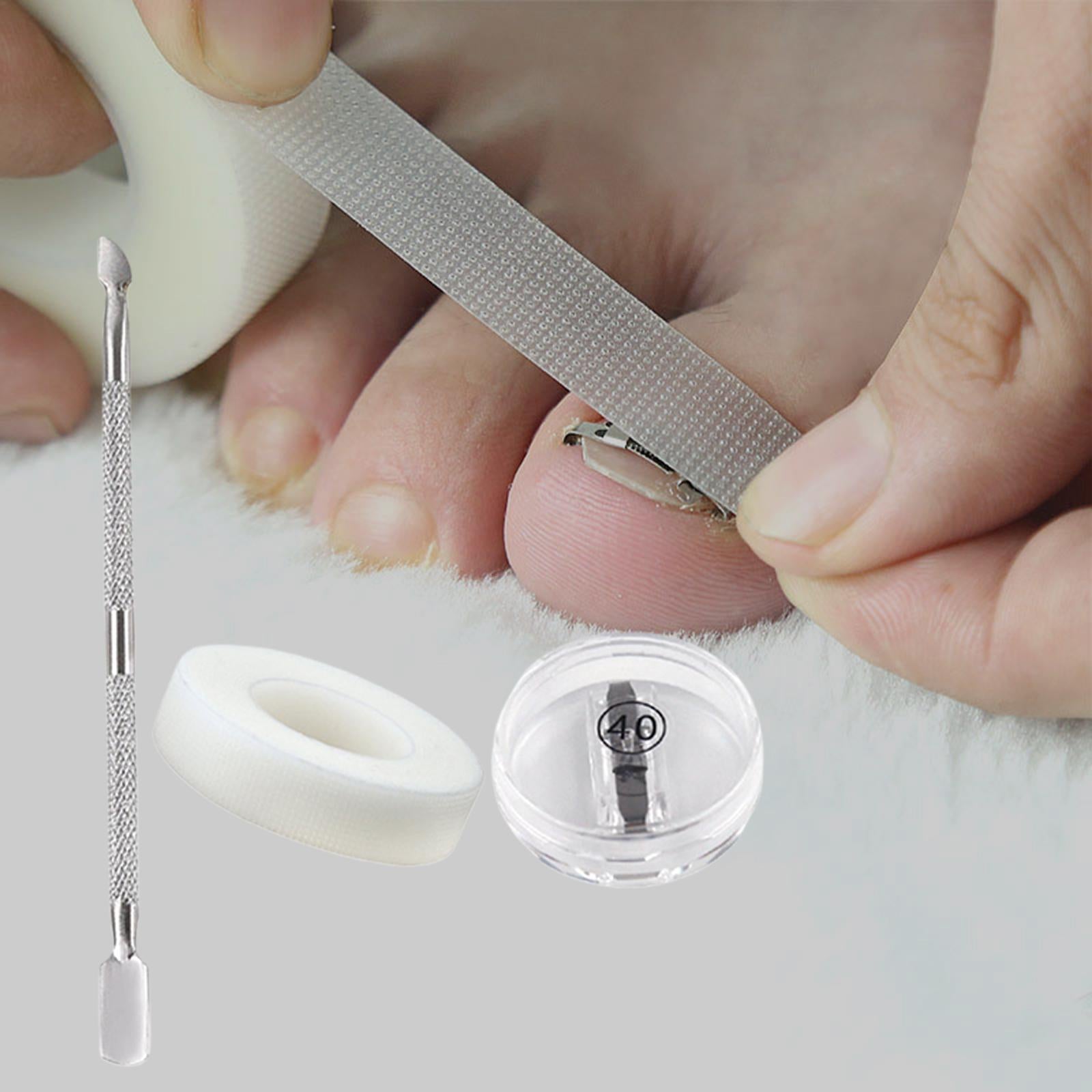 Ingrown Toenail Correction Tool Stainless Steel Reusable Foot Care 40