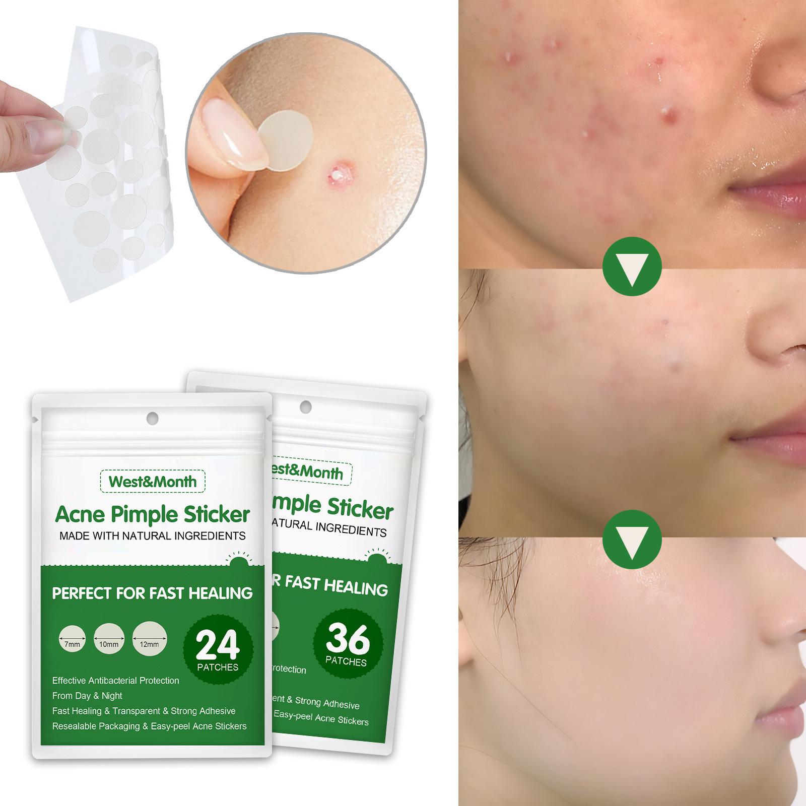 Pimple Acne Treatment Stickers Perfect for Fast Easy-Peel Pack of 36