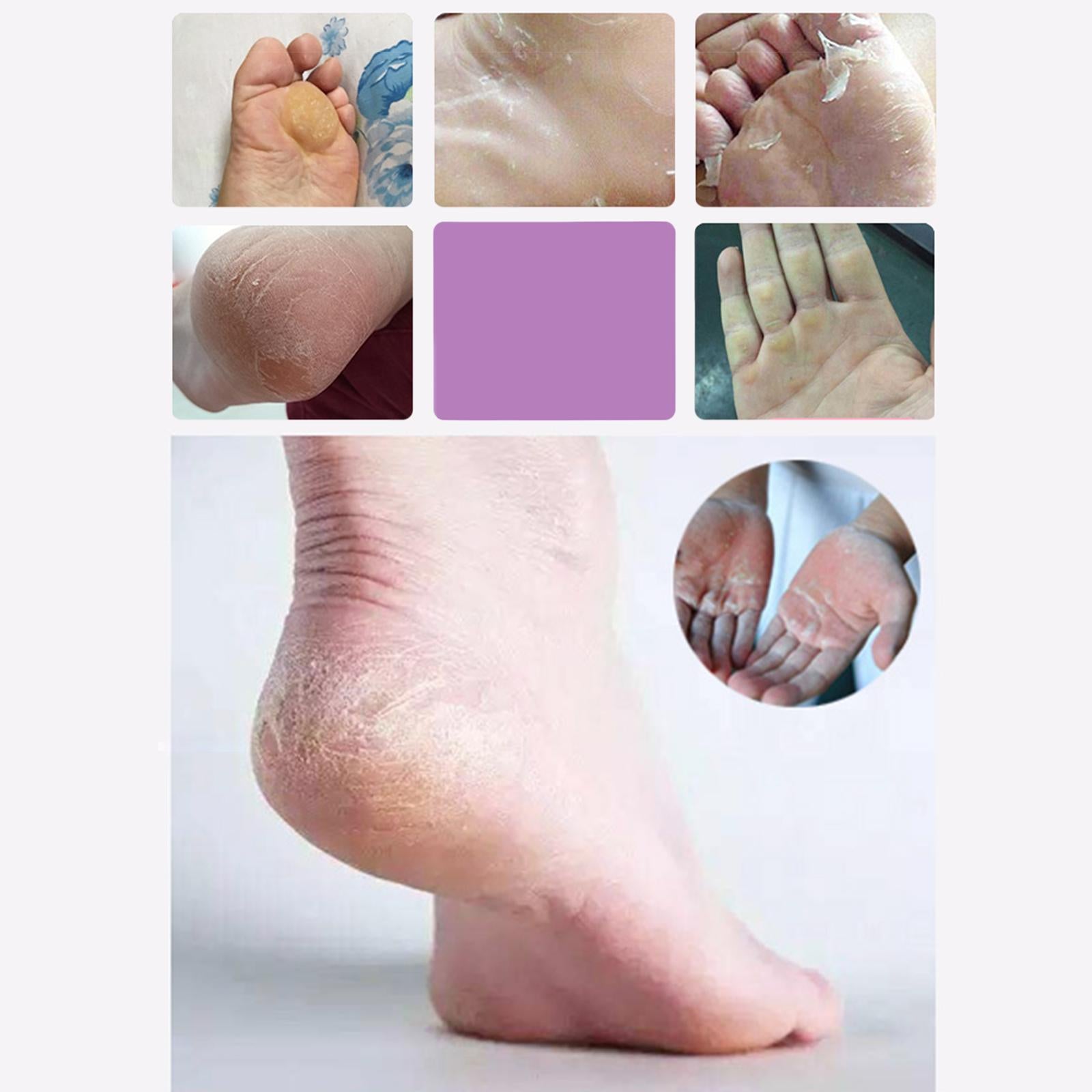 Foot files Stainless Steel Durable for Cracked Heels Trimming Dead Skin Black