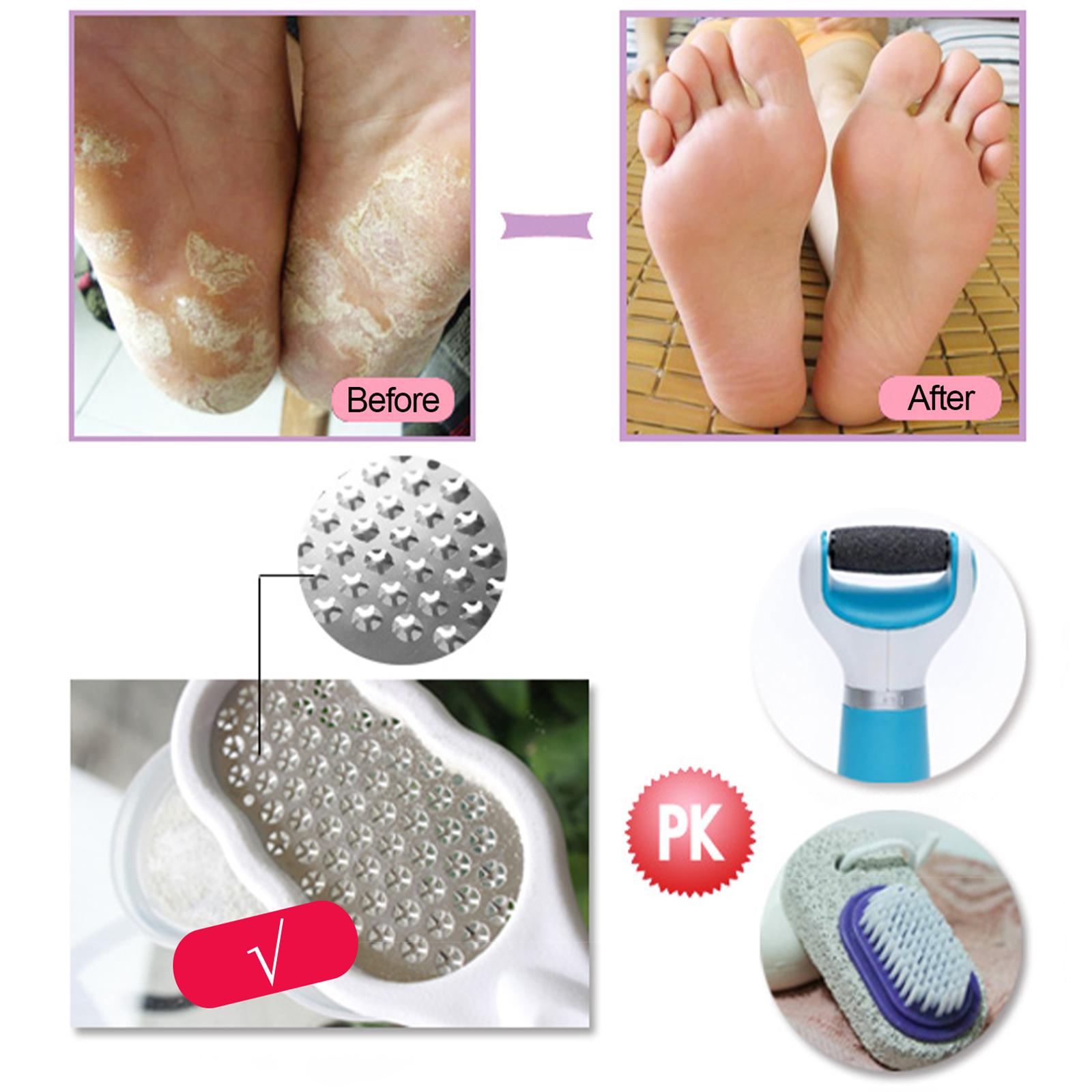 Foot files Stainless Steel Durable for Cracked Heels Trimming Dead Skin White