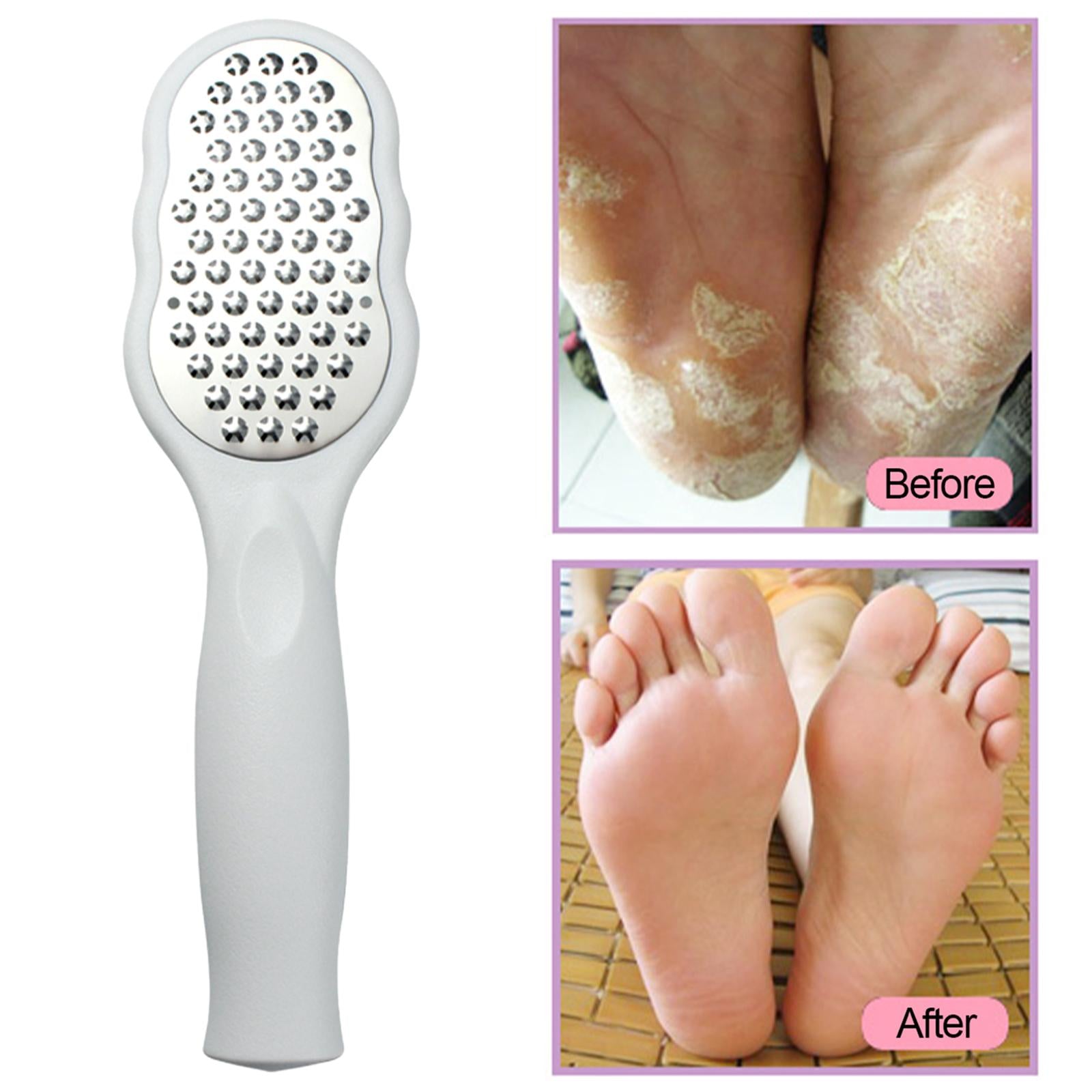 Foot files Stainless Steel Durable for Cracked Heels Trimming Dead Skin White