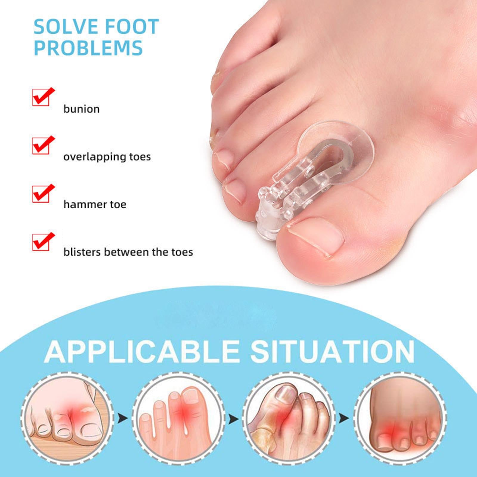 2Pcs Toe Separators Bunions Corrector Spacers Overlapping Toes Bent Toes