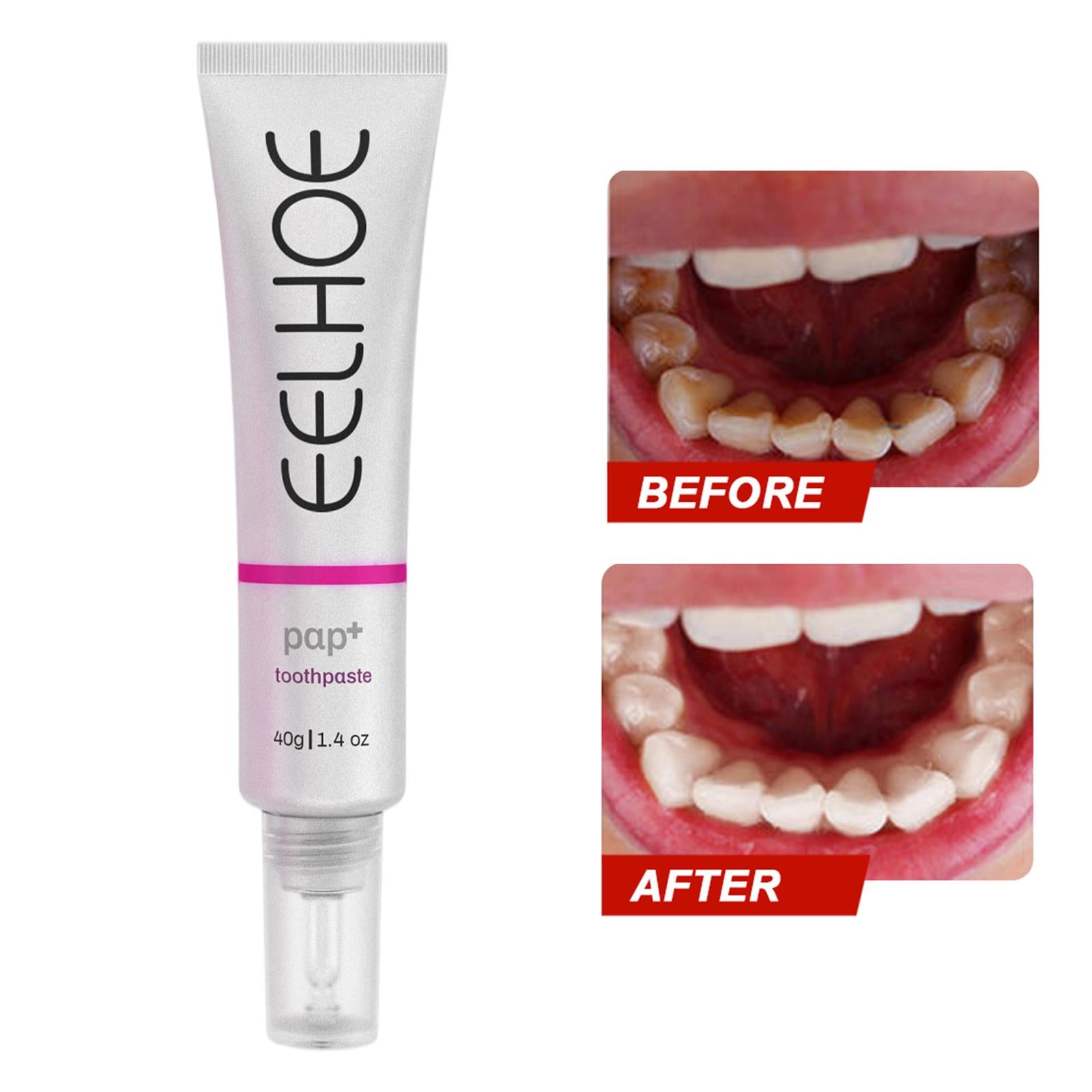 40g Teeth Whitening Toothpaste Stain Removal for Tooth Cleaning Fresh Breath