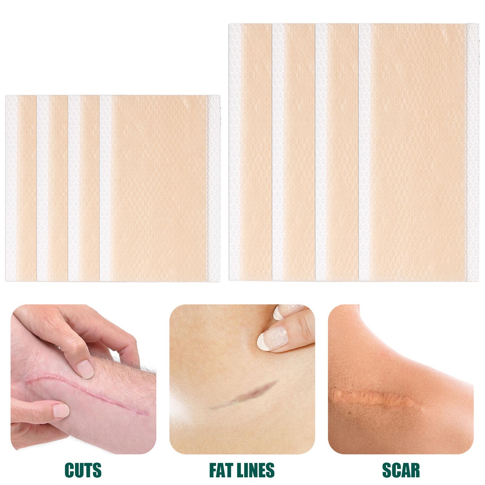 Silicone Scar Removal Sheets Soften Old and New Scars Soft 7.5x4cm
