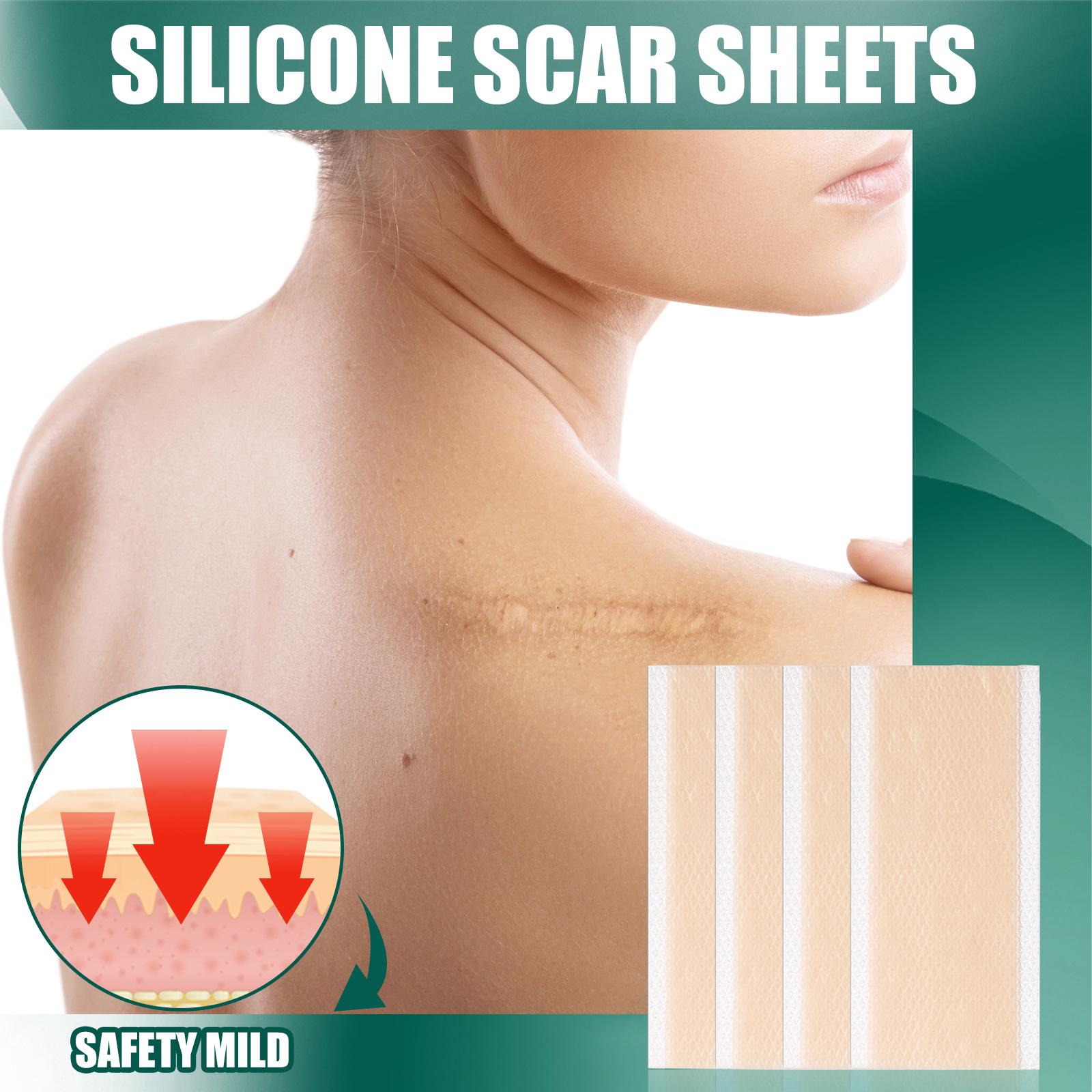 Silicone Scar Removal Sheets Soften Old and New Scars Soft 15x4cm