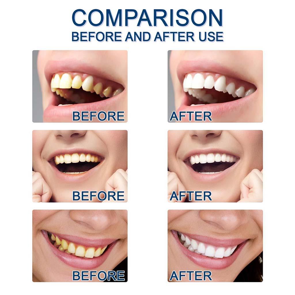 Teeth Whitening Essence Whiten Tooth Cleaning Care Tools for Travel Friendly