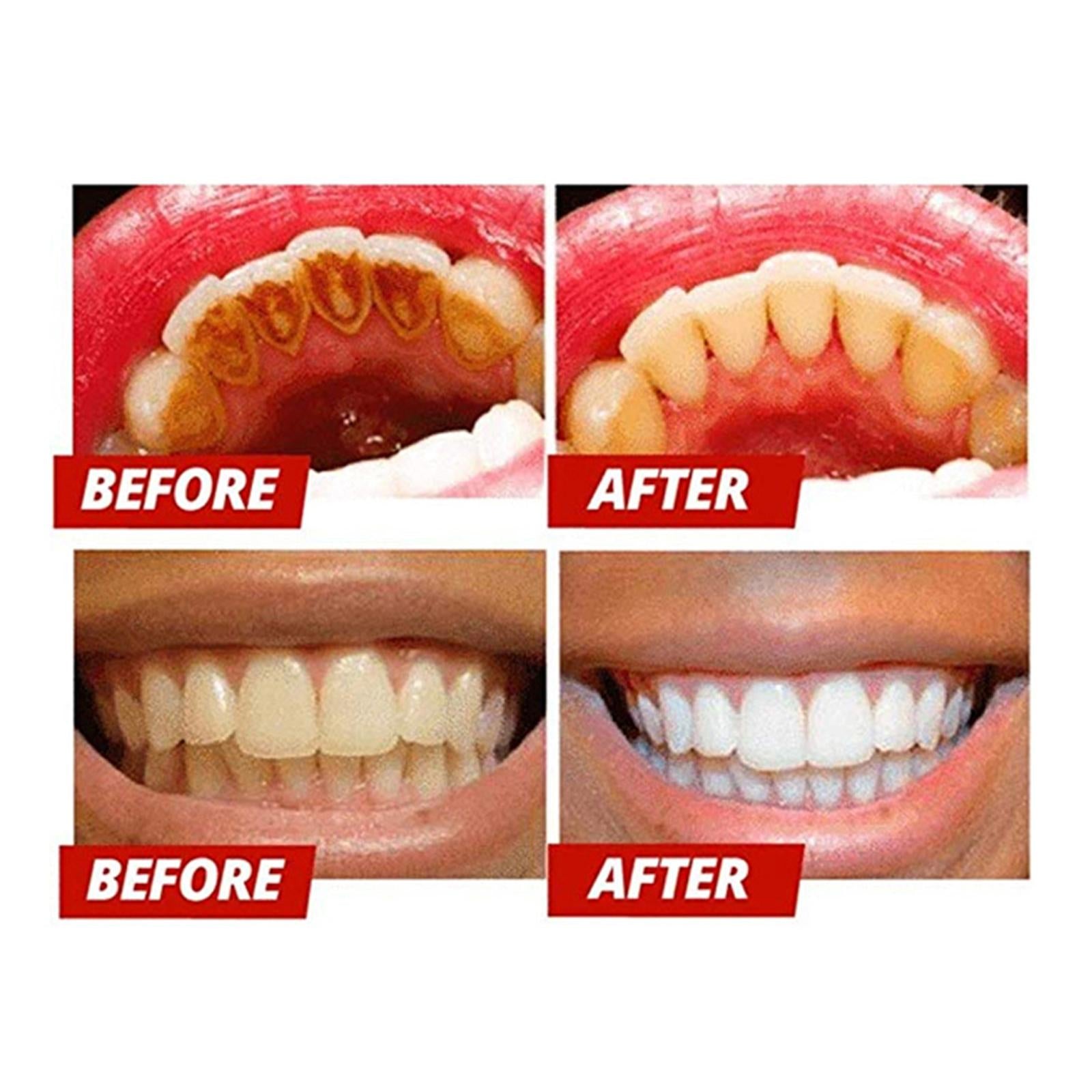 Tooth Powder Mint Leaves for Bright Tooth Remove Plaque Stains Cleaning